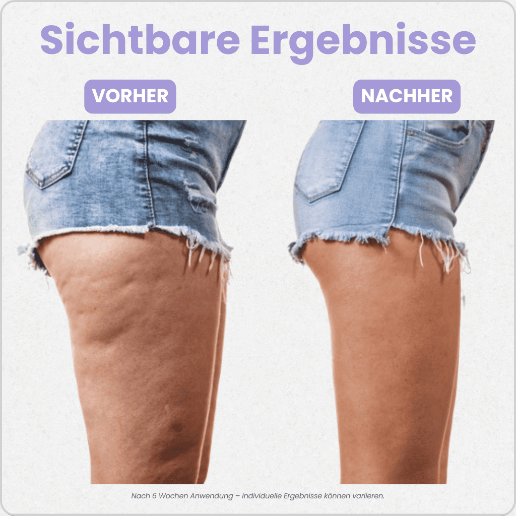 HeyLift™ Körper-Straffer